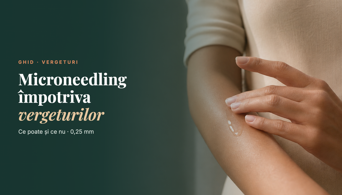 Poate microneedling-ul de acasă să trateze vergeturile?