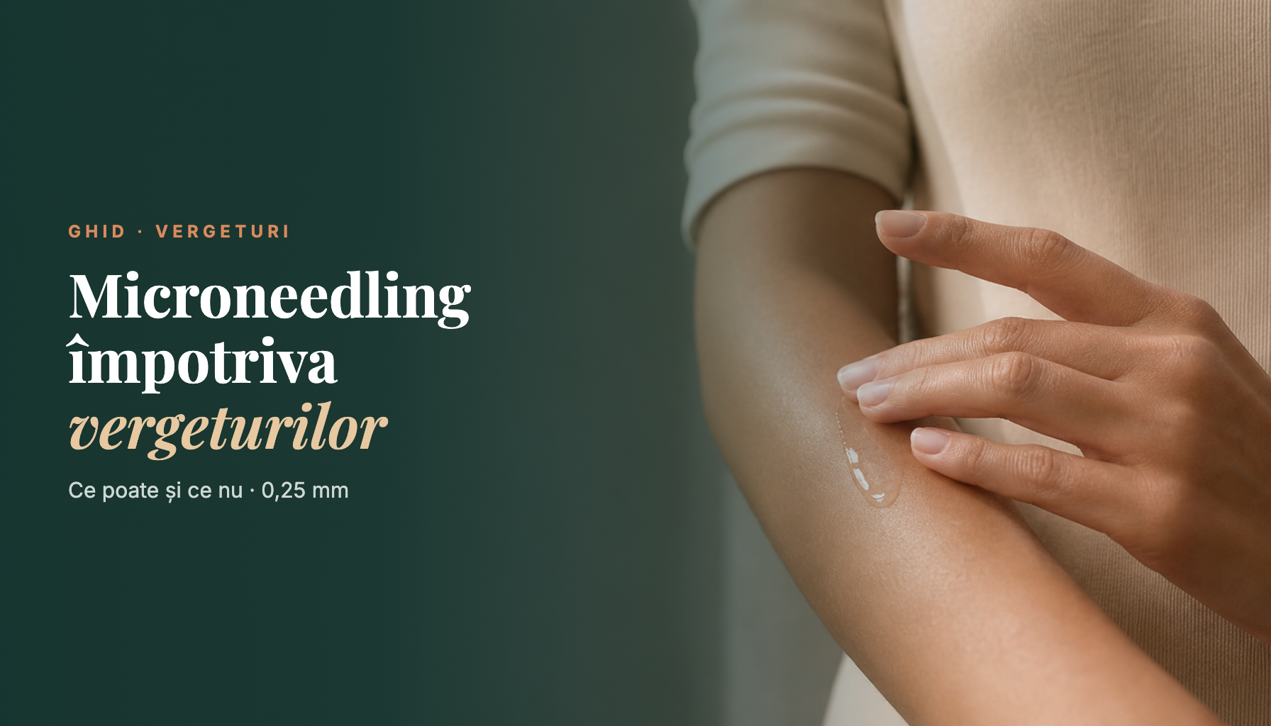 Poate microneedling-ul de acasă să trateze vergeturile?