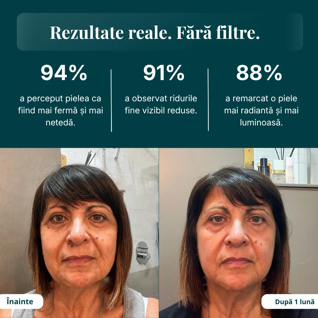 Rezultate reale — Înainte / După 1 lună