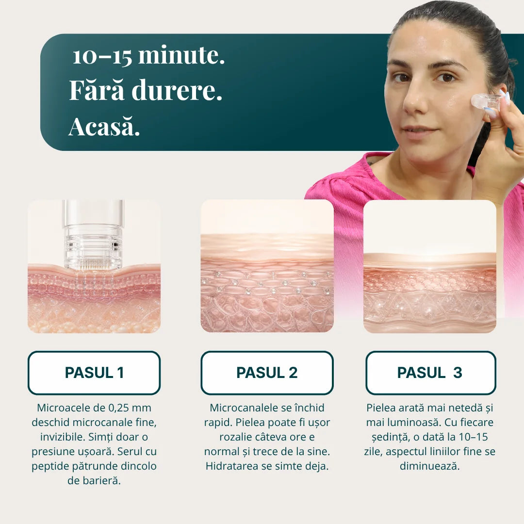 Nuviapel Micro Infusion System